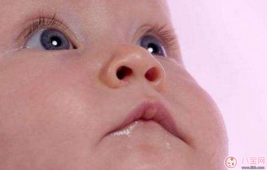 寶寶斜視手術(shù)風(fēng)險大嗎 寶寶斜視一定要做手術(shù)嗎 寶寶斜視手術(shù)風(fēng)險大嗎 寶寶斜視一定要做手術(shù)嗎