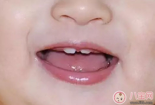 寶寶牙縫寬是什么原因 寶寶牙縫寬會(huì)自己閉攏嗎 寶寶牙縫寬是什么原因 寶寶牙縫寬會(huì)自己閉攏嗎