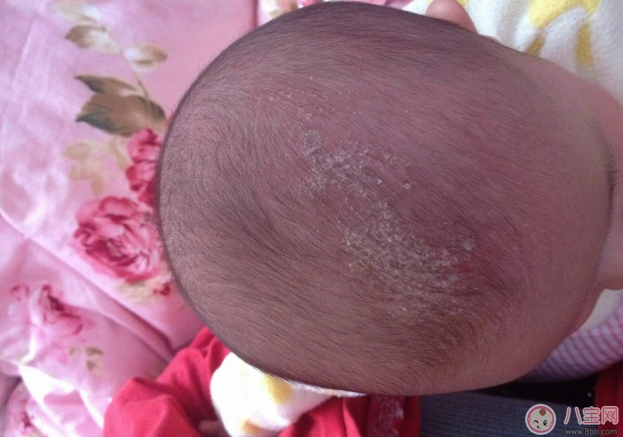 孩子其實這些地方特別臟 洗的時候千萬別忘