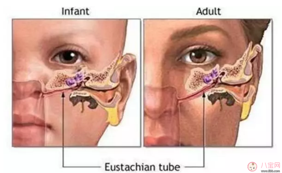 寶寶耳朵痛 小心感冒引起中耳炎 寶寶耳朵痛 小心感冒引起中耳炎