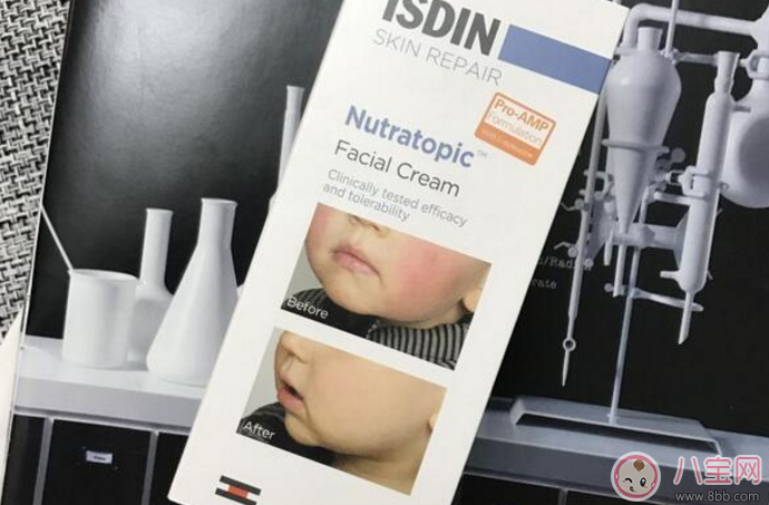 痱子和濕疹有什么區(qū)別 怎么預(yù)防痱子和濕疹 痱子和濕疹有什么區(qū)別 怎么預(yù)防痱子和濕疹