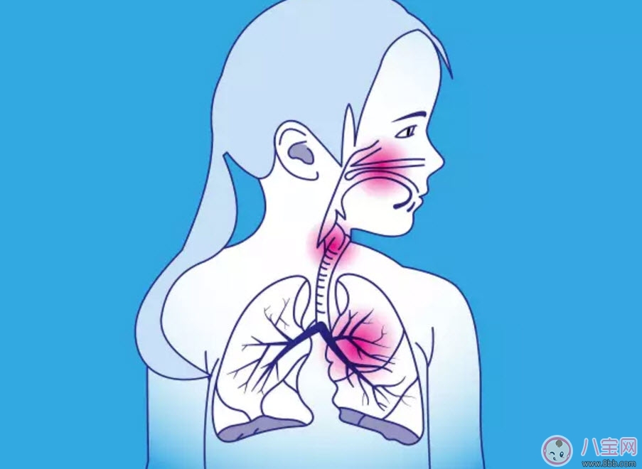 寶寶肺炎反反復(fù)復(fù)怎么辦 寶寶得了肺炎怎么治療 寶寶肺炎反反復(fù)復(fù)怎么辦 寶寶得了肺炎怎么治療