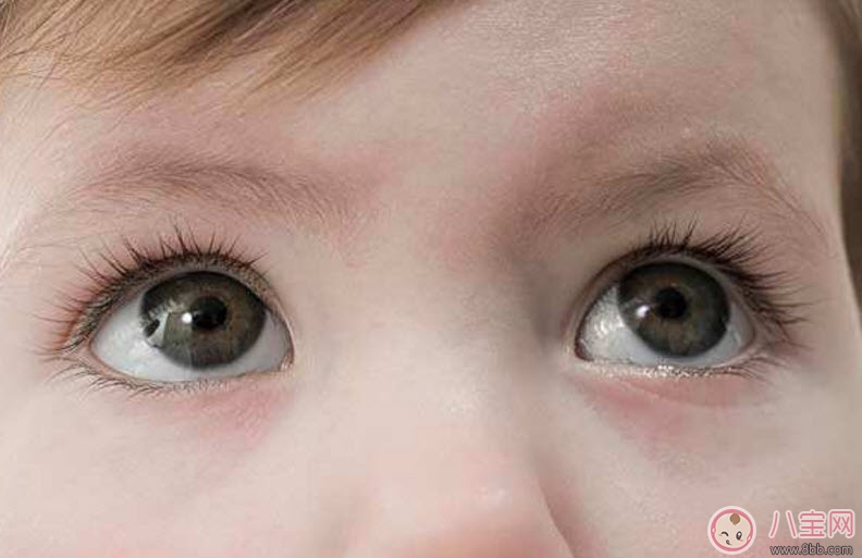 哪些情況要給寶寶用眼藥水 寶寶眼藥水怎么滴 哪些情況要給寶寶用眼藥水 寶寶眼藥水怎么滴