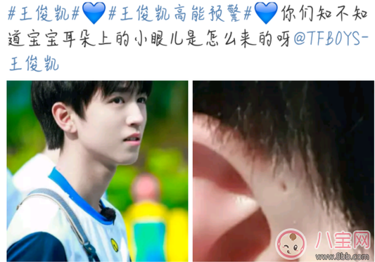 孩子耳朵上面有小孔是什么 耳朵的小孔是富貴孔嗎 孩子耳朵上面有小孔是什么 耳朵的小孔是富貴孔嗎