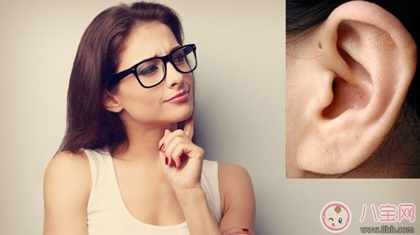 孩子耳朵上面有小孔是什么 耳朵的小孔是富貴孔嗎 孩子耳朵上面有小孔是什么 耳朵的小孔是富貴孔嗎