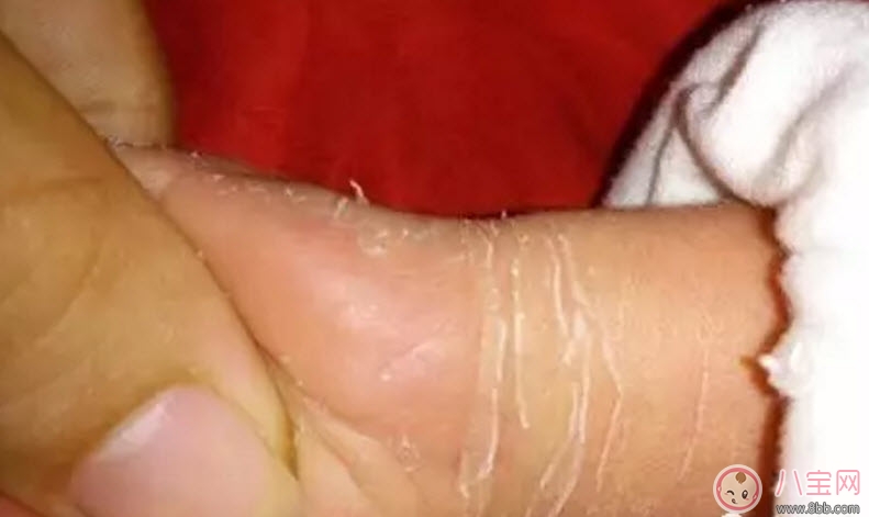 新生兒手腳脫皮要多久 新生兒脫皮怎么護(hù)理(能搽點(diǎn)什么) 新生兒手腳脫皮要多久 新生兒脫皮怎么護(hù)理(能搽點(diǎn)什么)