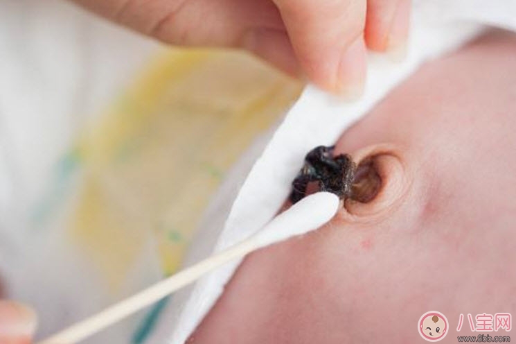 新生兒臍帶消毒用什么 臍帶消毒用碘伏好還是酒精(肚臍消毒圖解) 新生兒臍帶消毒用什么 臍帶消毒用碘伏好還是酒精(肚臍消毒圖解)