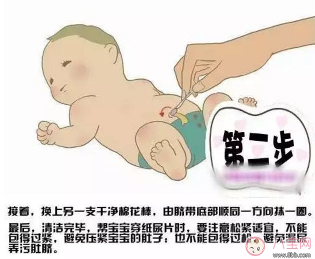 新生兒臍帶消毒用什么 臍帶消毒用碘伏好還是酒精(肚臍消毒圖解) 新生兒臍帶消毒用什么 臍帶消毒用碘伏好還是酒精(肚臍消毒圖解)