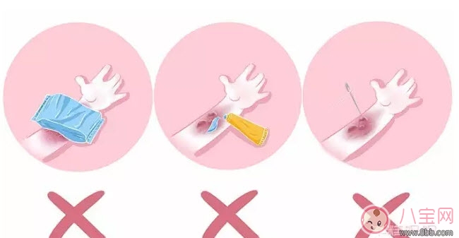 寶寶燙傷怎么辦 寶寶燙傷急救處理方法 寶寶燙傷怎么辦 寶寶燙傷急救處理方法