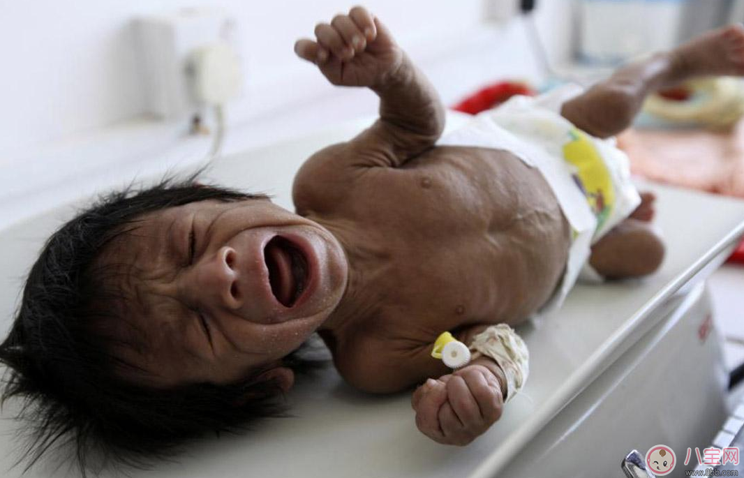 孩子這種情況居然是營(yíng)養(yǎng)不良的暗示 快給孩子調(diào)整過(guò)來(lái)