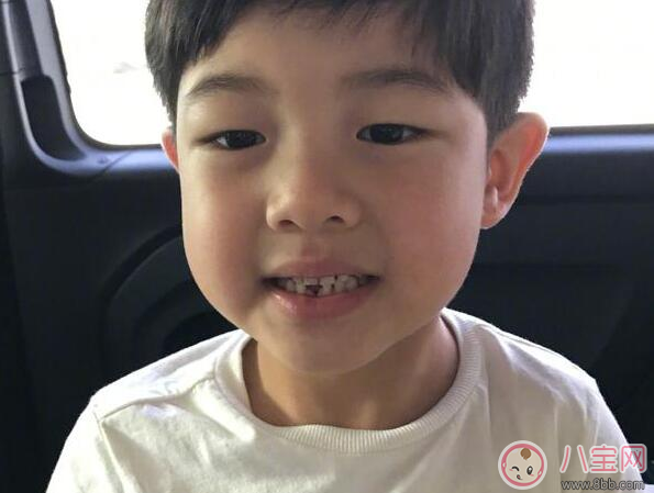 孩子出牙晚是福氣好嗎 哪些情況會(huì)影響孩子出牙