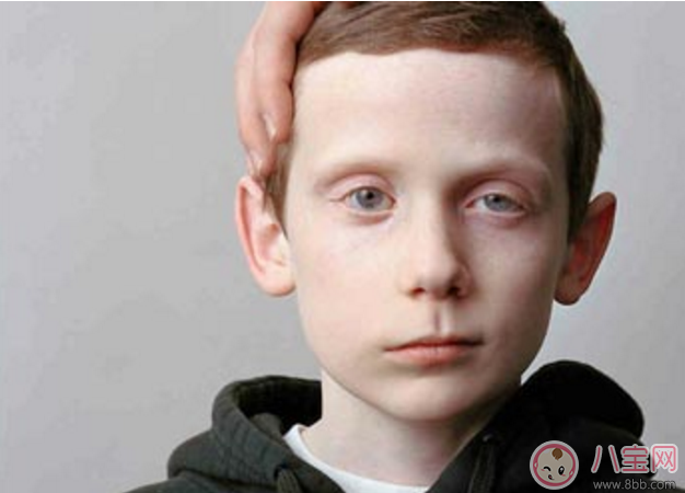 兒童吹空調(diào)竟然導(dǎo)致面癱 如何正確吹空調(diào) 兒童吹空調(diào)竟然導(dǎo)致面癱 如何正確吹空調(diào)