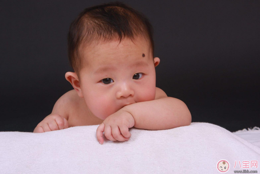 寶寶胎記會(huì)自己掉嗎 寶寶胎記去除方法 寶寶胎記會(huì)自己掉嗎 寶寶胎記去除方法