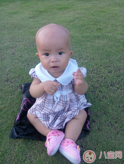 孩子夏天剃光頭 小心一不小心變禿頭 孩子夏天剃光頭 小心一不小心變禿頭