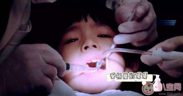 董潔兒子頂頂四顆蛀牙 寶寶更易患蛀牙問題 董潔兒子頂頂四顆蛀牙 寶寶更易患蛀牙問題