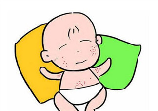 2017夏天孩子長痱子有什么偏方 去治痱子偏方有哪些