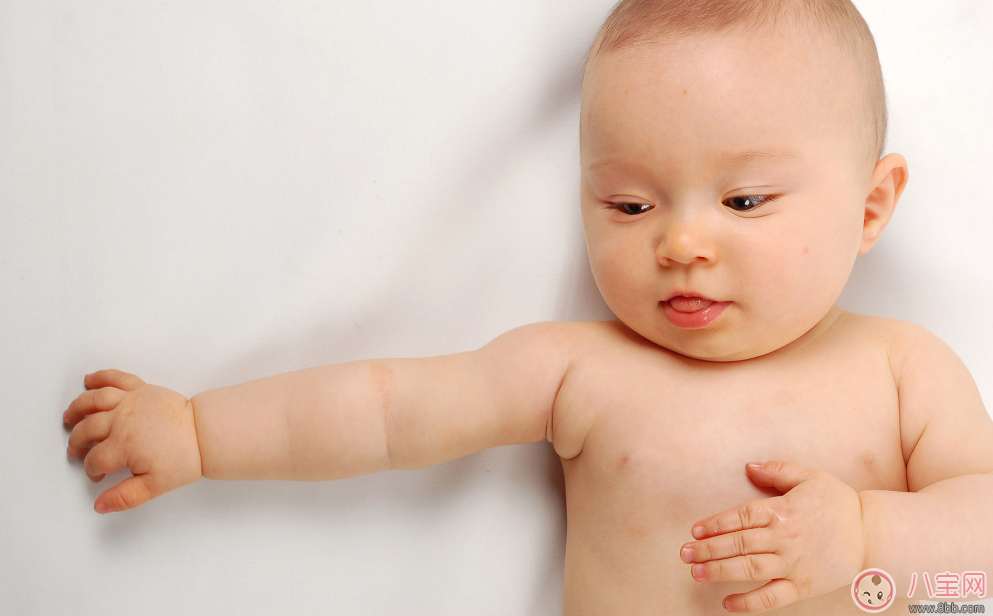 糖寶寶在嬰兒時期有哪些癥狀 怎么預(yù)防唐氏綜合癥 糖寶寶在嬰兒時期有哪些癥狀 怎么預(yù)防唐氏綜合癥