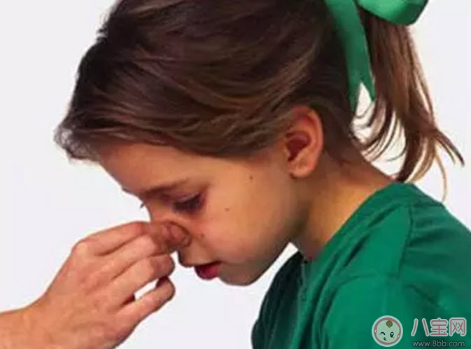 2017夏天孩子上火流鼻血怎么辦 孩子流鼻血正確處理方法 2017夏天孩子上火流鼻血怎么辦 孩子流鼻血正確處理方法