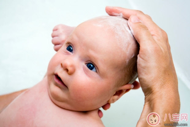 頭垢對(duì)寶寶的影響 頭垢怎么去除有哪些注意事項(xiàng)