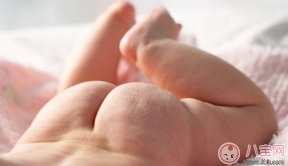 嬰兒長尿布疹怎么辦 尿布疹是怎么引起的