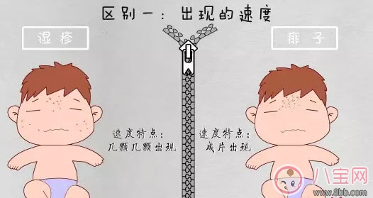 寶寶痱子和濕疹的區(qū)別 濕疹和痱子的區(qū)別圖片 寶寶痱子和濕疹的區(qū)別 濕疹和痱子的區(qū)別圖片