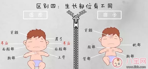 寶寶痱子和濕疹的區(qū)別 濕疹和痱子的區(qū)別圖片 寶寶痱子和濕疹的區(qū)別 濕疹和痱子的區(qū)別圖片
