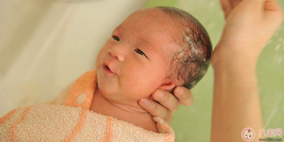 寶寶乳痂多怎么辦    怎么清洗乳痂