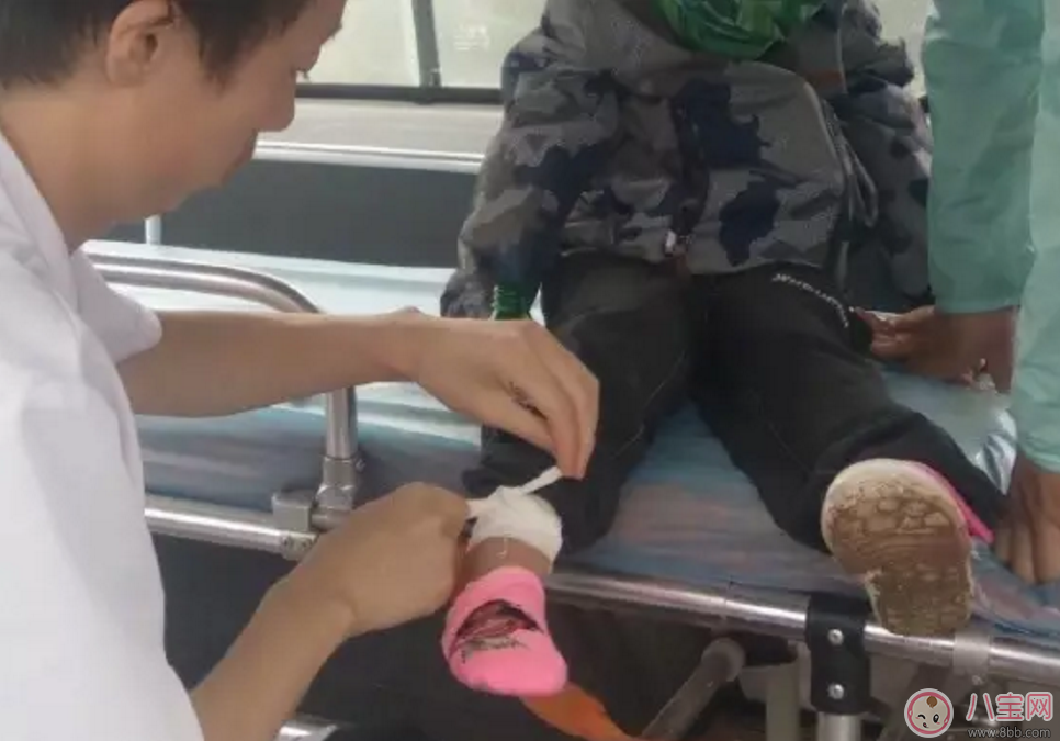 樂嘉帶4歲女兒穿越沙漠徒步76公里 女兒腿上發(fā)滿皰疹 樂嘉帶4歲女兒穿越沙漠徒步76公里 女兒腿上發(fā)滿皰疹