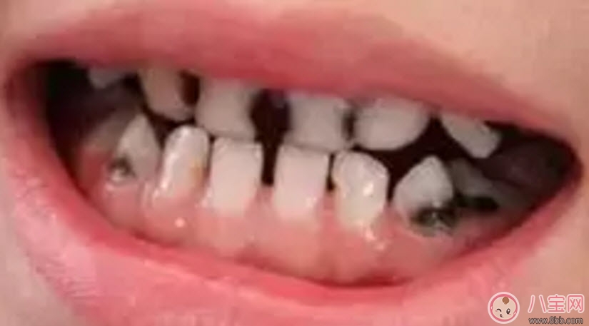 寶寶一直不愛刷牙 找對方法很關(guān)鍵