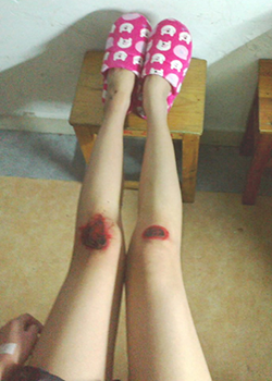 美女膝蓋內(nèi)涵圖  妹子你的腿腫么了美女膝蓋紅了