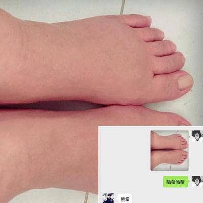 伊能靜懷孕曬大肚子照片 臨產(chǎn)腳腫如熊掌