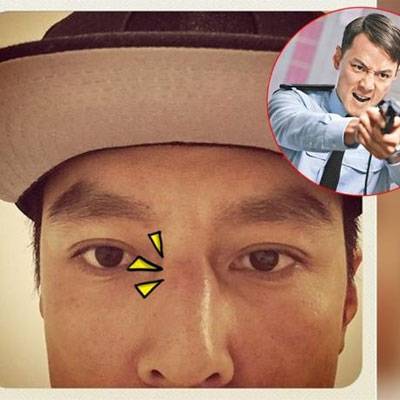 太敬業(yè)！吳彥祖鼻梁被打斷直接直接掰回來