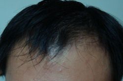 頭發(fā)護理小常識 怎樣讓頭發(fā)變多