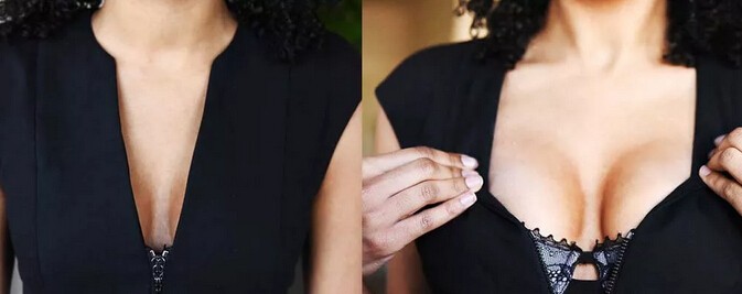 這樣也可以 不用動刀塑造豐滿胸部效果