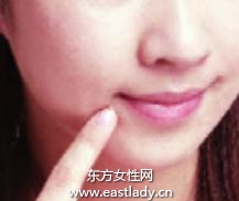 粉刺、痘痘肌膚的化妝技巧