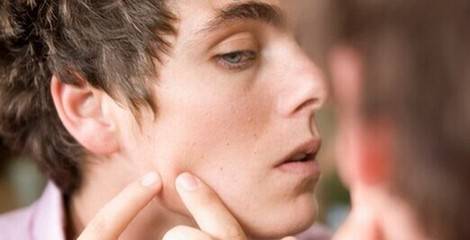 如何清除粉刺 粉刺和痘痘又有什么區(qū)別