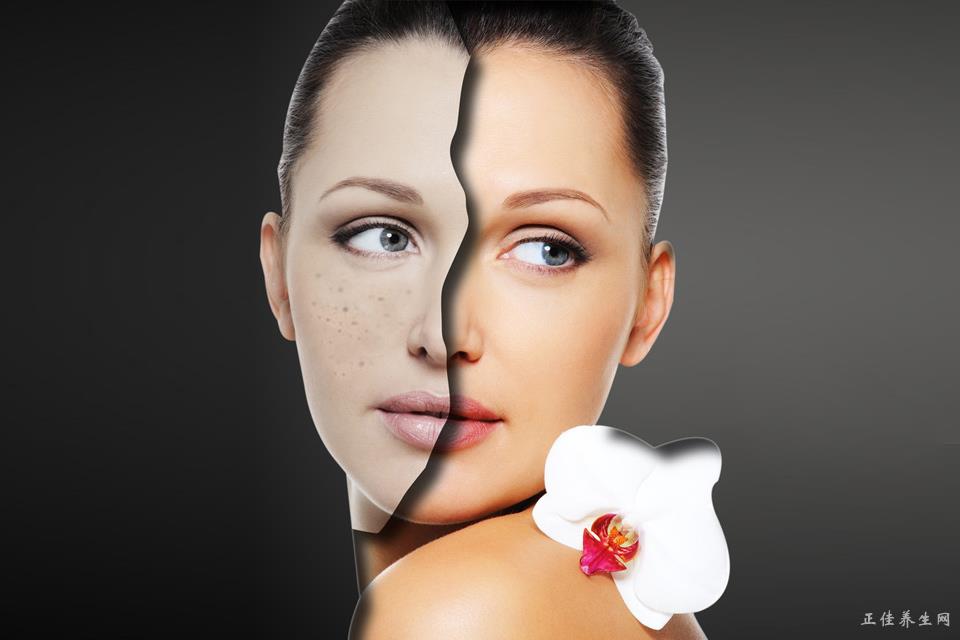 教你祛痘小秘方