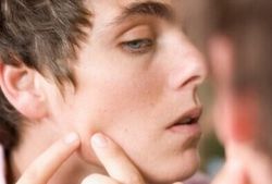 如何清除粉刺 粉刺和痘痘又有什么區(qū)別