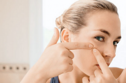 正確清除粉刺的六個步驟 手殘黨趕緊get