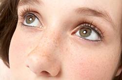 如何有效去除色斑黃褐斑