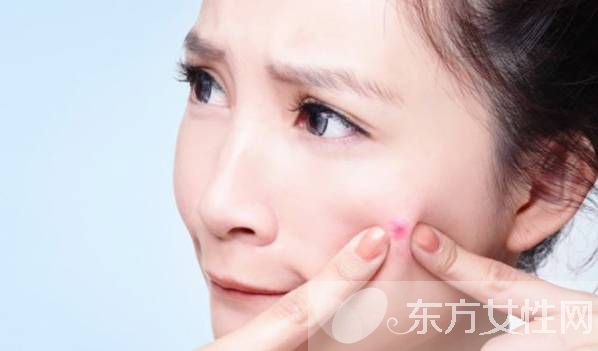 粉刺和痘痘的區(qū)別 這么做可以有效預(yù)防青春痘哦