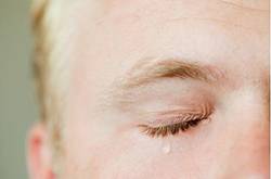 怎樣消除眉間皺紋 四大方法任你選擇