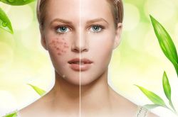 痘坑修復(fù)水能快速的解決痘印問(wèn)題 是真的嗎