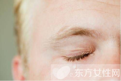 怎樣消除眉間皺紋 四大方法任你選擇