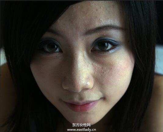 五個(gè)簡(jiǎn)單小妙招 讓你跟青春痘疤痕say goodbye