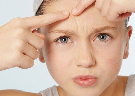 五個簡單小妙招 讓你跟青春痘疤痕say goodbye