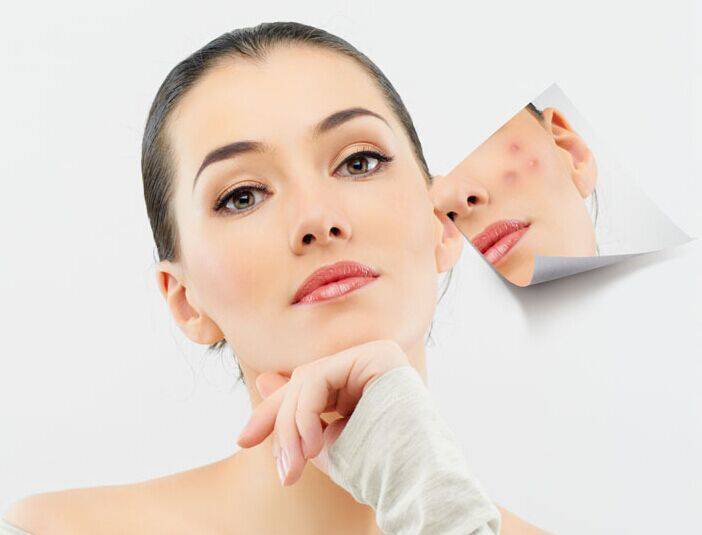 激光祛痘有好有壞 揭密你所不知的副作用