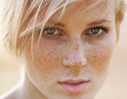臉頰兩側(cè)長斑的原因 2個小竅門教你如何祛斑
