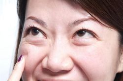 怎么去黑眼圈和眼袋 消除黑眼圈眼袋這么做就夠了