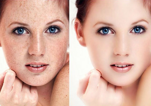 祈顏流金歲月助你輕松下 斑 無需美顏